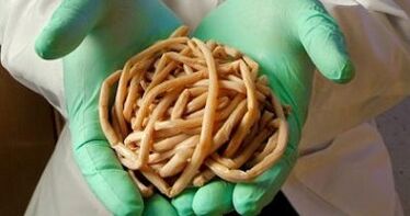 从人体中提取的寄生虫
