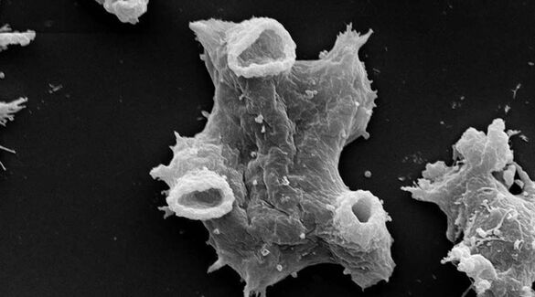 Negleria fowlera 是一种对人类生命有害的原生动物寄生虫。