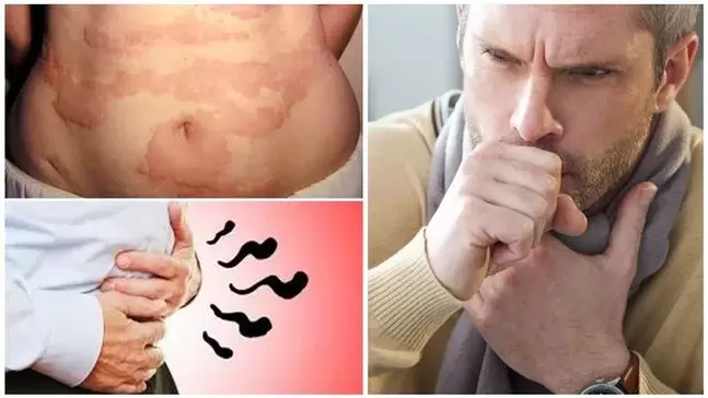 过敏、咳嗽和腹胀是蠕虫对身体造成损害的迹象